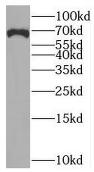 BRCC3 Rabbit Polyclonal Antibody