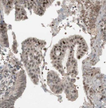 BRCC3 Rabbit Polyclonal Antibody