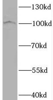 BRD3 Rabbit Polyclonal Antibody