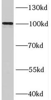 BRIP1 Rabbit Polyclonal Antibody