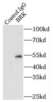 PTK6 Rabbit Polyclonal Antibody