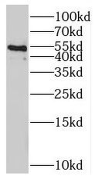 PTK6 Rabbit Polyclonal Antibody