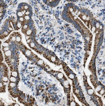PTK6 Rabbit Polyclonal Antibody