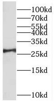 BRMS1 Antibody