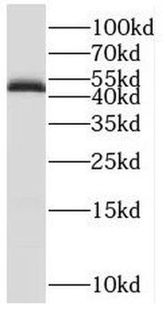 POU3F2 Rabbit Polyclonal Antibody