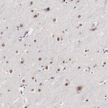 POU3F2 Rabbit Polyclonal Antibody