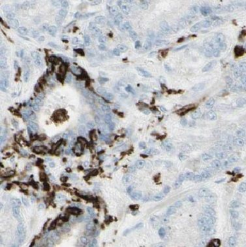 BRSK2 Rabbit Polyclonal Antibody