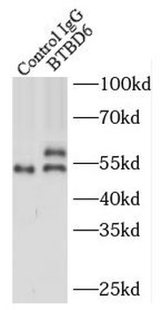 BTBD6 Antibody