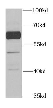 BTD Rabbit Polyclonal Antibody