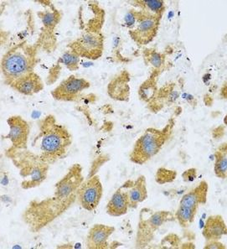 BTD Rabbit Polyclonal Antibody