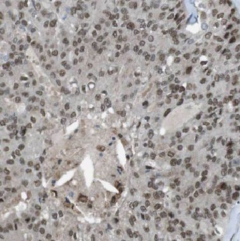 BTG1 Rabbit Polyclonal Antibody
