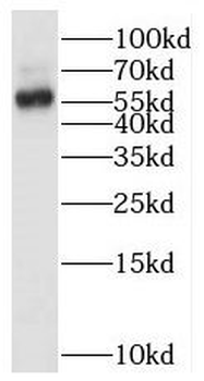 BTN2A2 Rabbit Polyclonal Antibody