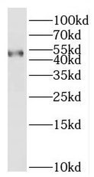 BTNL8 Rabbit Polyclonal Antibody