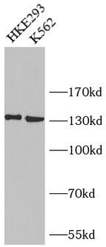 BUB1 Rabbit Polyclonal Antibody