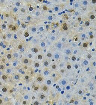 BUB1 Rabbit Polyclonal Antibody