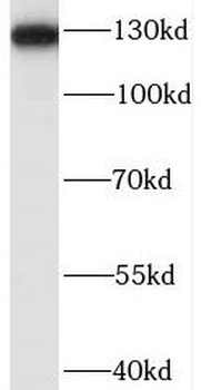 BUB1B Antibody