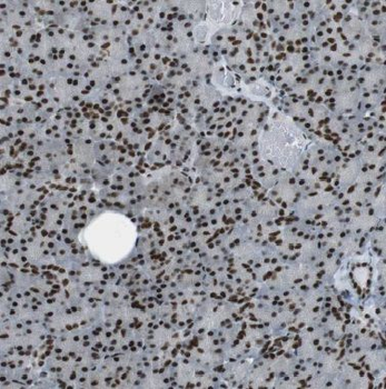 BRIX1 Rabbit Polyclonal Antibody