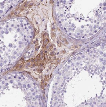 BZW1 Rabbit Polyclonal Antibody