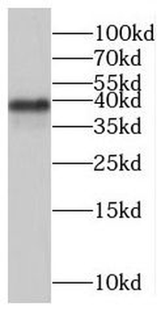 TBATA Rabbit Polyclonal Antibody