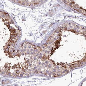 TBATA Rabbit Polyclonal Antibody