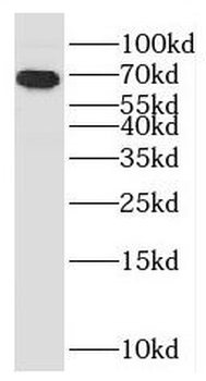 CCDC7 Rabbit Polyclonal Antibody