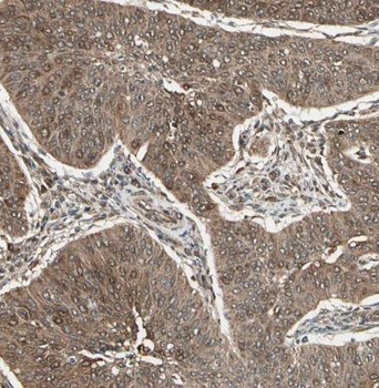 CCDC7 Rabbit Polyclonal Antibody