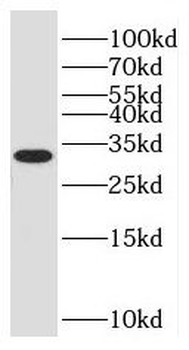 NKAPD1 Rabbit Polyclonal Antibody