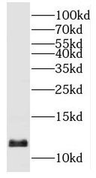 SLIRP Rabbit Polyclonal Antibody