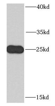 RTRAF Rabbit Polyclonal Antibody