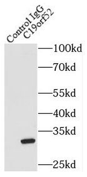 TIMM29 Rabbit Polyclonal Antibody