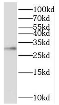 TIMM29 Rabbit Polyclonal Antibody