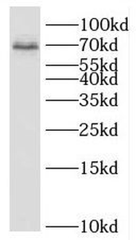 BRME1 Rabbit Polyclonal Antibody