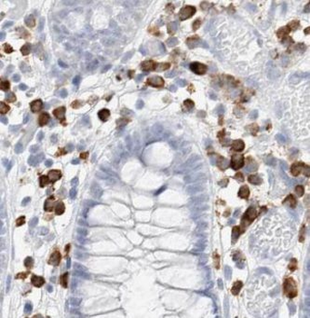 INAVA Rabbit Polyclonal Antibody