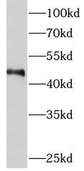 METTL18 Rabbit Polyclonal Antibody