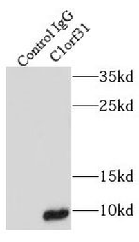 COA6 Rabbit Polyclonal Antibody