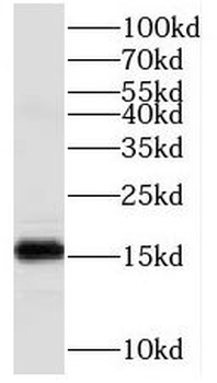 COA6 Rabbit Polyclonal Antibody