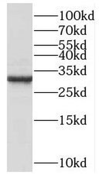C1QBP Rabbit Polyclonal Antibody
