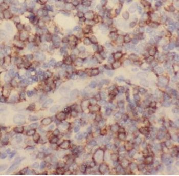 C1QBP Rabbit Polyclonal Antibody