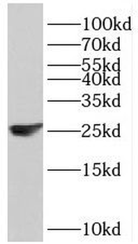 C1QC Rabbit Polyclonal Antibody