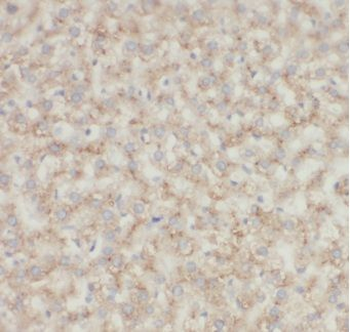 C1QC Rabbit Polyclonal Antibody