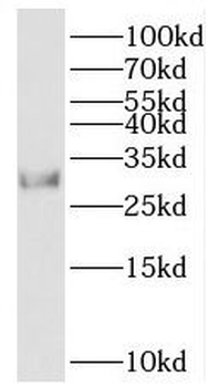 GID8 Rabbit Polyclonal Antibody