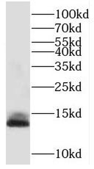 TMEM230 Rabbit Polyclonal Antibody