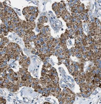 TMEM230 Rabbit Polyclonal Antibody