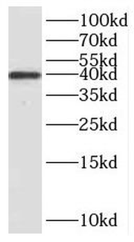 RTF2 Rabbit Polyclonal Antibody