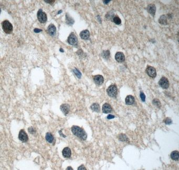 C21orf58 Rabbit Polyclonal Antibody