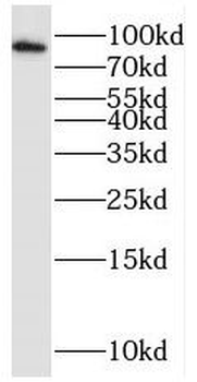 GCFC2 Rabbit Polyclonal Antibody