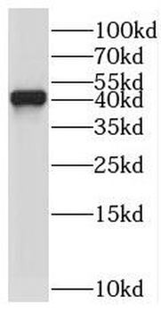 TYW5 Antibody