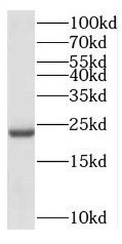 CEP19 Rabbit Polyclonal Antibody