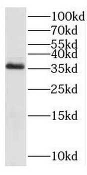 C3orf38 Rabbit Polyclonal Antibody
