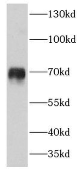 C4BPA Rabbit Polyclonal Antibody